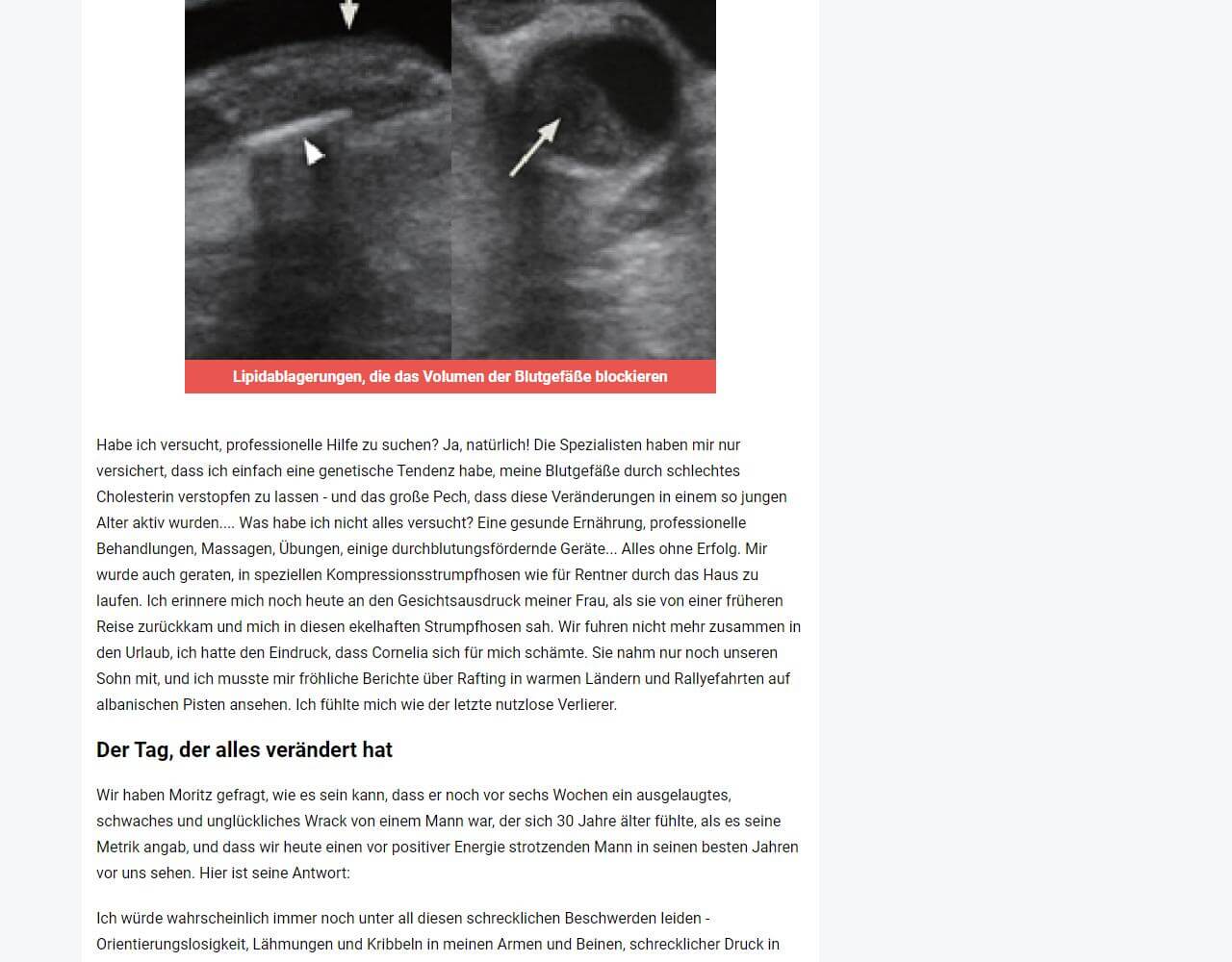 Cardiotensive 4