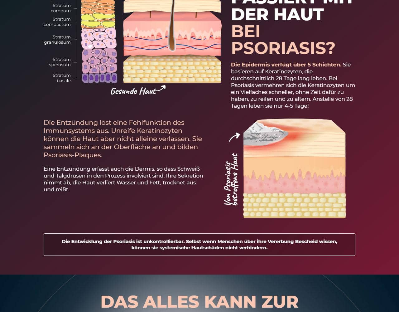 Psoriaderm 2