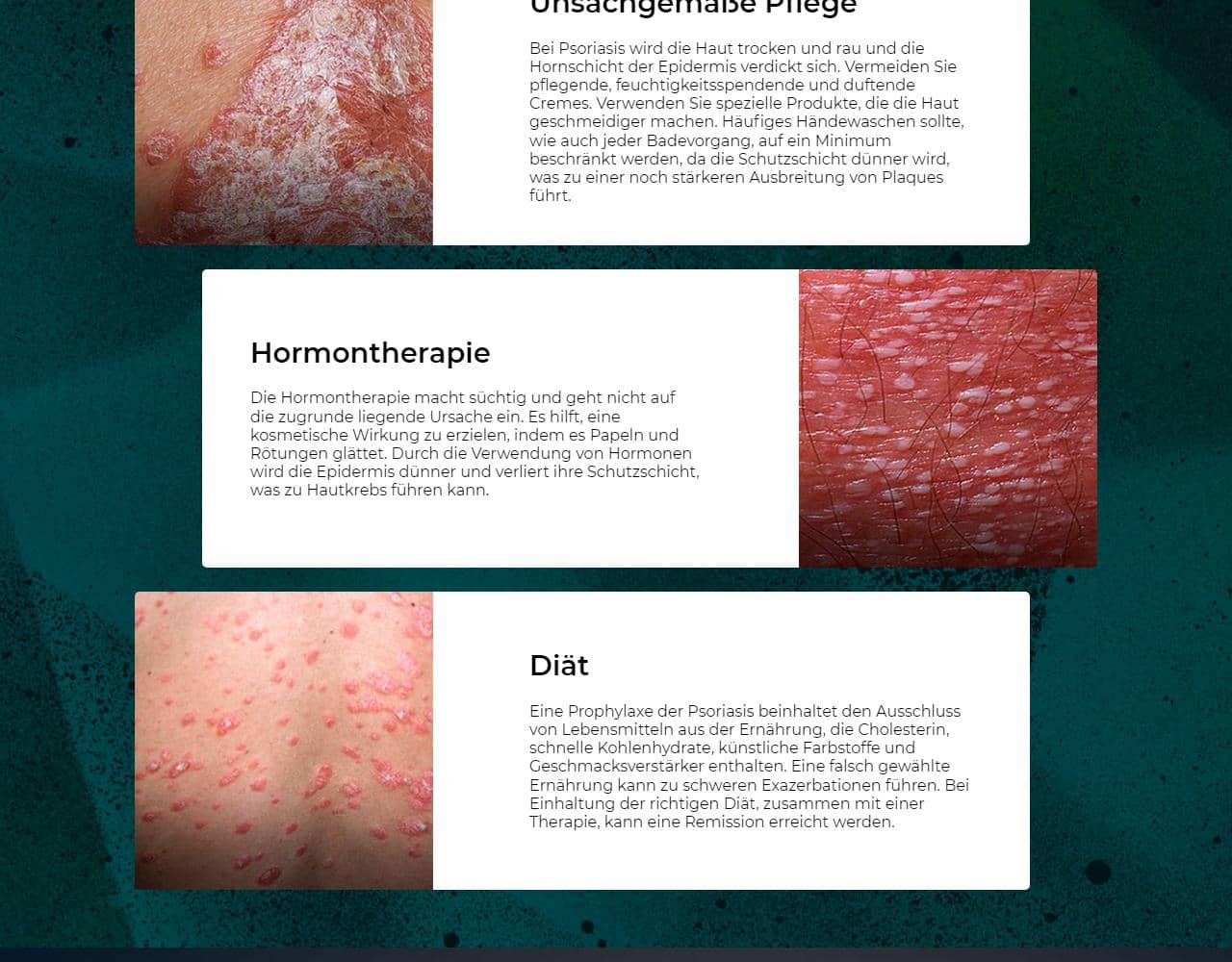 Psoriaderm 4